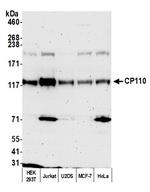 CP110 Polyclonal Antibody
