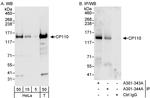 CP110 Polyclonal Antibody