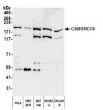 CSB/ERCC6 Polyclonal Antibody