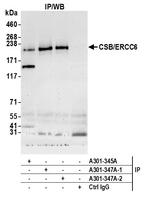CSB/ERCC6 Polyclonal Antibody