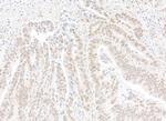 CPSF68 Antibody in Immunohistochemistry (Paraffin) (IHC (P))