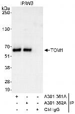 TOM1 Polyclonal Antibody
