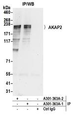 AKAP2 Antibody in Immunoprecipitation (IP)