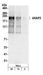 AKAP2 Polyclonal Antibody