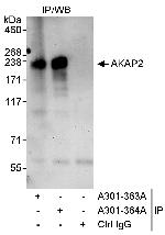 AKAP2 Polyclonal Antibody