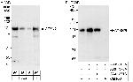 ATXN2L Polyclonal Antibody