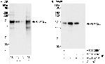 ATXN2L Polyclonal Antibody