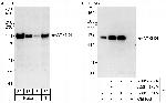 ATXN2L Polyclonal Antibody