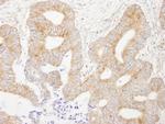 AKAP1 Antibody in Immunohistochemistry (Paraffin) (IHC (P))
