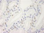 UACA Polyclonal Antibody