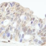 HDAC7 Polyclonal Antibody