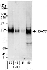 HDAC7 Antibody in Western Blot (WB)