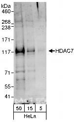 HDAC7 Antibody in Western Blot (WB)
