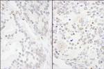 ANKS3 Polyclonal Antibody