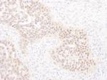 WRNIP1 Polyclonal Antibody