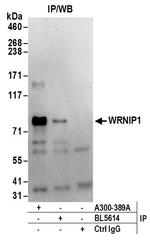 WRNIP1 Antibody in Immunoprecipitation (IP)