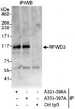 RFWD3 Polyclonal Antibody