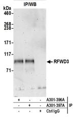 RFWD3 Polyclonal Antibody