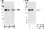 Anillin Antibody in Western Blot (WB)