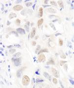 Anillin Polyclonal Antibody