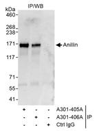 Anillin Antibody in Immunoprecipitation (IP)