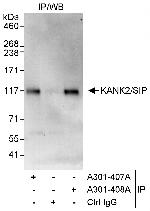 KANK2/SIP Polyclonal Antibody