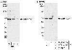 ANKRD57 Antibody in Western Blot (WB)