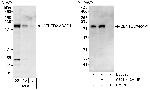 CENTD2/ARAP1 Polyclonal Antibody