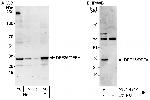 DFF35/DFFA Polyclonal Antibody