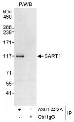 SART1 Polyclonal Antibody