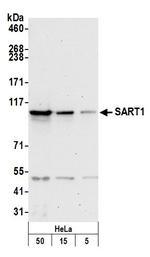 SART1 Polyclonal Antibody