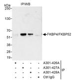 FKBP4/FKBP52 Antibody in Immunoprecipitation (IP)