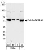 FKBP4/FKBP52 Antibody in Western Blot (WB)