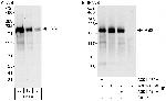 IRS2 Polyclonal Antibody