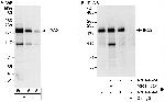 IRS2 Polyclonal Antibody