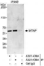 WTAP Polyclonal Antibody
