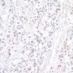 WDR79 Polyclonal Antibody