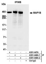 MAP1B Polyclonal Antibody