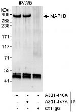 MAP1B Polyclonal Antibody