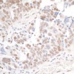 PHF6 Polyclonal Antibody