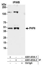 PHF6 Antibody in Immunoprecipitation (IP)