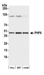PHF6 Antibody in Western Blot (WB)