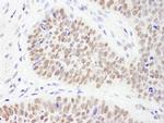 PHF6 Polyclonal Antibody