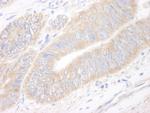 CIP2A Polyclonal Antibody
