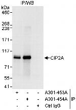 CIP2A Antibody in Immunoprecipitation (IP)