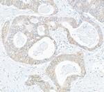CIP2A Polyclonal Antibody