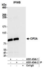 CIP2A Antibody in Immunoprecipitation (IP)