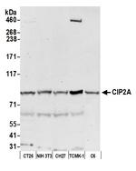 CIP2A Antibody in Western Blot (WB)