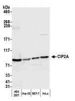 CIP2A Antibody in Western Blot (WB)