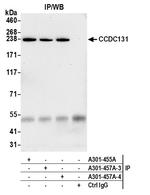 CCDC131 Antibody in Immunoprecipitation (IP)